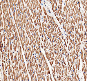 PYGM Antibody staining of human cardiac muscle by IHC. Immunohistochemistry of FFPE human cardiac muscle sections using the PYGM Antibody at 2 ug/ml. Strong brown cytoplasmic staining is distributed extensively throughout the cardiomyocytes, with clear preservation of the elongated muscle fibers and blue nuclear counterstaining. Heat-mediated antigen retrieval was performed in pH 8 EDTA before overnight primary antibody incubation at 4oC. The robust muscle staining is consistent with abundant PYGM expression in striated muscle and demonstrates detection of myophosphorylase with this Muscle Glycogen Phosphorylase Antibody.