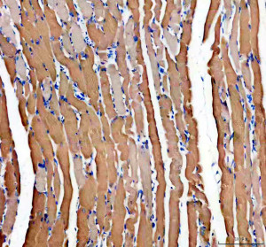 PYGM Antibody staining of mouse skeletal muscle by IHC. Immunohistochemistry of FFPE mouse skeletal muscle tissue sections using the PYGM Antibody at 2 ug/ml. Brown cytoplasmic staining is evident throughout the longitudinally oriented skeletal muscle fibers, with some variation in staining intensity between fibers. Elongated muscle fibers are separated by narrow connective tissue spaces, and nuclei are counterstained blue. Heat-mediated antigen retrieval was performed in pH 8 EDTA before overnight primary antibody incubation at 4oC. The observed staining pattern is consistent with the localization of myophosphorylase in skeletal muscle and demonstrates tissue detection with this Muscle Glycogen Phosphorylase Antibody.