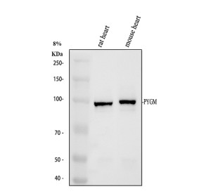 PYGM Antibody detection in rat and mouse heart by WB. Western blot testing of rat heart (lane 1) and mouse heart (lane 2) tissue lysates with the PYGM Antibody at 0.5 ug/ml under reducing conditions. Thirty micrograms of protein were loaded per lane. A strong, discrete band is detected at approximately 97 kDa in both samples, closely matching the calculated molecular weight of 97.1 kDa for PYGM. The clean signal in both species demonstrates recognition of myophosphorylase by this Muscle Glycogen Phosphorylase Antibody.