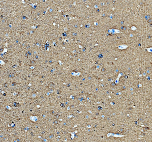 DPYSL5 Antibody by IHC in Human Brain Immunohistochemistry of paraffin-embedded human brain sections using DPYSL5 Antibody. The CRMP5 Polyclonal Antibody produces prominent cytoplasmic staining within neuronal cells and surrounding neuropil, with comparatively limited nuclear labeling. The staining distribution is consistent with the cytoplasmic localization and neuronal association of DPYSL5/CRMP5. Heat-mediated antigen retrieval was performed using EDTA buffer at pH 8.0 prior to antibody incubation.
