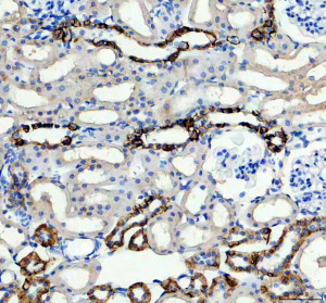 Carbonic Anhydrase XII Antibody by IHC in rat kidney. Immunohistochemistry of FFPE rat kidney tissue using Carbonic Anhydrase XII Antibody at 2 ug/ml. Strong brown immunoreactivity is observed along the membranes of selected renal tubular epithelial cells, with comparatively weak staining in surrounding structures. The well-defined tubular architecture and localized staining pattern are consistent with the membrane-associated distribution of CA12 in renal tissue. Hematoxylin counterstaining highlights blue-purple nuclei. Heat-mediated antigen retrieval was performed using EDTA buffer at pH 8.0, followed by overnight primary antibody incubation at 4oC. This CA12 Polyclonal Antibody demonstrates prominent tubular epithelial immunoreactivity.