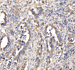 DLST Antibody by IHC in human appendix tissue. Immunohistochemistry of FFPE human appendix tissue using DLST Antibody at 2 ug/ml. Brown DAB immunoreactivity is detected in the tissue section, with hematoxylin counterstaining highlighting nuclei and tissue architecture. Heat-induced epitope retrieval was performed using EDTA buffer at pH 8.0, followed by overnight primary antibody incubation at 4oC. This Dihydrolipoamide Succinyltransferase Antibody recognizes a mitochondrial enzyme involved in oxidative metabolism.