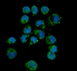 DLST Antibody by IF in human T47D cells. Immunofluorescence staining of human T47D cells using DLST Antibody at 5 ug/ml. Green fluorescence indicates DLST immunoreactivity, while nuclei are counterstained blue with DAPI. Enzymatic antigen retrieval was performed for 15 minutes, followed by overnight primary antibody incubation at 4oC. Fluoro488-conjugated goat anti-rabbit IgG was used at 1:500. This Dihydrolipoamide Succinyltransferase Antibody detects a mitochondrial enzyme involved in the TCA cycle.