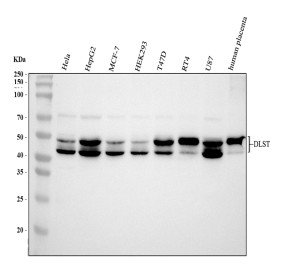 DLST Antibody by WB in human cells and placenta tissue. Western blot analysis using DLST Antibody at 0.5 ug/ml. Lanes 1-7: human HeLa, HepG2, MCF7, HEK293, T47D, RT4, and U87 cell lysates; lane 8: human placenta tissue lysate. Samples were separated by 10% SDS-PAGE under reducing conditions, with 30 ug of protein loaded per lane. Immunoreactive bands are detected at approximately 43 and 49 kDa, consistent with the reported migration range of DLST. This Dihydrolipoamide Succinyltransferase Antibody recognizes the E2 component of the mitochondrial alpha-ketoglutarate dehydrogenase complex.