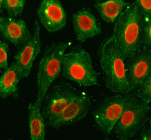 IFI16 Antibody by IF. Immunofluorescence staining of human SiHa cells using rabbit polyclonal IFI16 antibody at 5 ug/ml. Gamma-interferon-inducible protein 16 is detected predominantly in cell nuclei (red, Cy3), while alpha-tubulin staining highlights the cytoplasmic microtubule network (green, Fluoro488). The distinct nuclear localization of IFI16 contrasts with the filamentous cytoplasmic distribution of alpha-tubulin. Cells were treated with enzyme-based antigen retrieval for 15 minutes, followed by overnight primary antibody incubation at 4oC and fluorescent secondary antibody detection.
