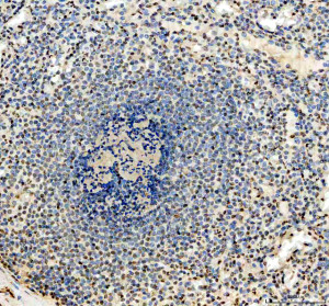 IFI16 Antibody by IHC. Immunohistochemistry staining of FFPE human spleen tissue using rabbit polyclonal IFI16 antibody at 2 ug/ml. Gamma-interferon-inducible protein 16 immunoreactivity is observed in scattered cells throughout the lymphoid tissue, with predominantly nuclear staining and variable intensity among individual cells. The lymphoid follicle contains numerous hematoxylin-counterstained nuclei with comparatively limited brown labeling. Heat-induced antigen retrieval was performed using EDTA buffer (pH 8.0), followed by overnight primary antibody incubation at 4oC and DAB-based detection.