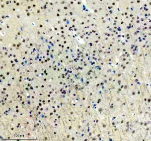 PPIG Antibody by IHC in Mouse Brain Tissue. Immunohistochemistry staining of FFPE mouse brain tissue using rabbit polyclonal PPIG antibody at 2 ug/ml. Cyclophilin G immunoreactivity is detected in numerous cell nuclei throughout the examined brain region, with variable staining intensity and relatively limited cytoplasmic labeling. The surrounding neuropil exhibits weak background staining. Heat-induced antigen retrieval was performed using EDTA buffer (pH 8.0), followed by overnight primary antibody incubation at 4oC and DAB-based detection.
