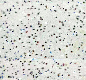 PPIG Antibody by IHC in Rat Brain Tissue. Immunohistochemistry staining of FFPE rat brain tissue using rabbit polyclonal PPIG antibody at 2 ug/ml. Cyclophilin G immunoreactivity is observed in scattered cells, with predominantly nuclear staining of varying intensity. Many surrounding cells exhibit weak or undetectable labeling, producing a heterogeneous distribution of positive nuclei. Heat-induced antigen retrieval was performed using EDTA buffer (pH 8.0), followed by overnight primary antibody incubation at 4oC and DAB-based detection.