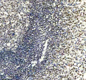 PPIG Antibody by IHC in Human Tonsil Tissue. Immunohistochemistry staining of FFPE human tonsil tissue using rabbit polyclonal PPIG antibody at 2 ug/ml. Cyclophilin G immunoreactivity is observed in scattered lymphoid and stromal cells, with weak to moderate nuclear-associated brown staining. The densely populated lymphoid regions contain numerous hematoxylin-counterstained nuclei with comparatively limited DAB labeling. Heat-induced antigen retrieval was performed using EDTA buffer (pH 8.0), followed by overnight primary antibody incubation at 4oC and DAB-based detection.
