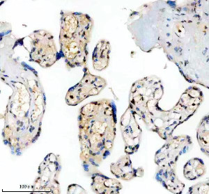 PPIG Antibody by IHC in Human Placental Chorionic Villi. Immunohistochemistry staining of FFPE human placenta tissue using rabbit polyclonal PPIG antibody at 2 ug/ml. Cyclophilin G immunoreactivity is observed in cells lining chorionic villous structures, with predominantly nuclear-associated brown staining and additional diffuse cytoplasmic labeling in some regions. The staining varies among individual villi, while numerous stromal nuclei remain comparatively weakly labeled. Heat-induced antigen retrieval was performed using EDTA buffer (pH 8.0), followed by overnight primary antibody incubation at 4oC and DAB-based detection.