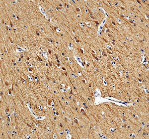 LRP11 Antibody by IHC in Human Brain Tissue. Immunohistochemistry staining of FFPE human brain tissue using rabbit polyclonal LRP11 antibody at 2 ug/ml. Heat-induced epitope retrieval was performed using EDTA buffer at pH 8.0. Tissue sections were blocked with 10% goat serum and incubated with primary antibody overnight at 4oC, followed by peroxidase-conjugated goat anti-rabbit IgG and DAB chromogenic detection. Brown immunoreactivity is distributed throughout the neuropil, with prominent staining of neuronal cell bodies and their processes. The predominantly cytoplasmic and process-associated staining pattern demonstrates the distribution of LDL Receptor Related Protein 11 immunoreactivity in human brain tissue.