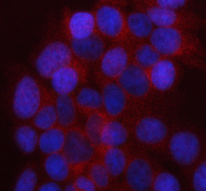 UAP1L1 Antibody by IF in Human MCF-7 Breast Cancer Cells. Immunofluorescence staining of human MCF-7 cells using rabbit polyclonal UAP1L1 antibody at 5 ug/ml. Enzymatic antigen retrieval was performed for 15 minutes, followed by blocking with 10% goat serum and overnight primary antibody incubation at 4oC. Cy3-conjugated goat anti-rabbit IgG was applied at 1:500 for 30 minutes at 37oC, and nuclei were counterstained with DAPI. Red fluorescence demonstrates UDP-GlcNAc Pyrophosphorylase-related protein UAP1L1 immunoreactivity, predominantly distributed throughout the cytoplasm with a diffuse, finely granular appearance. The blue DAPI-stained nuclei exhibit comparatively little red fluorescence.