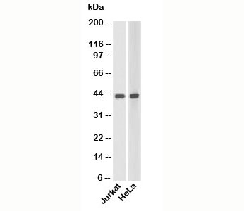 beta Actin antibody western blot of human samples