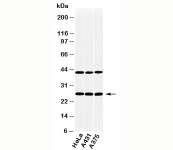 CLEC4E antibody western blot of human samples