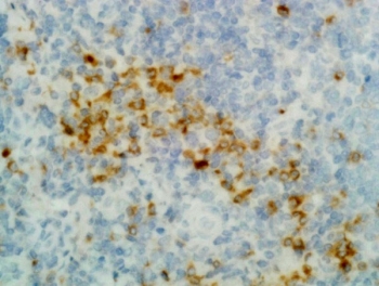 Human IgG Antibody Biotin Immunohistochemistry Human Tonsil Tissue. Immunohistochemistry analysis of FFPE human tonsil demonstrates that the parent clone RM116 antibody produces cytoplasmic staining in plasma cells and B cell-rich regions, with minimal background in surrounding stromal cells. This staining pattern supports detection of IgG / IGHG within antibody-producing cells and is representative of the performance retained in the biotinylated format of the Human IgG Antibody / Biotinylated Anti-Human IgG Detection Antibody. Heat-induced epitope retrieval was performed using a standard buffer prior to antibody incubation.