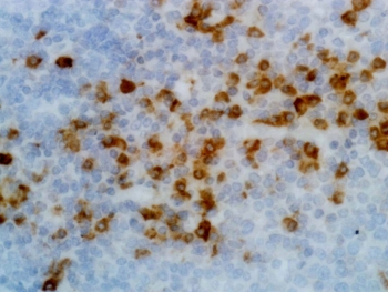 Human Kappa Light Chain Antibody Human Tonsil IHC. Immunohistochemistry analysis of Human kappa light chain / IGKC expression in FFPE human tonsil tissue using clone RM126 shows strong cytoplasmic and membranous staining in scattered plasma cells and B lymphocytes within lymphoid follicles, with surrounding non-lymphoid cells largely negative. The staining pattern highlights immunoglobulin-producing cells and is consistent with kappa light chain expression in antibody-secreting populations. Heat-induced epitope retrieval was performed using either pH6 citrate buffer or pH9 Tris-EDTA buffer prior to antibody incubation, supporting reliable detection in formalin-fixed paraffin-embedded tissue.