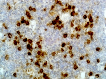 Biotinylated Human Lambda Light Chain Antibody for IHC-Human Tonsil Tissue Staining. Immunohistochemistry analysis of Human Lambda Light Chain expression in FFPE human tonsil tissue using the unlabeled parent Human Lambda Light Chain Antibody clone RM127 demonstrates strong cytoplasmic HRP-DAB brown staining in scattered plasma cells within lymphoid regions. The biotinylated Human Lambda Light Chain Antibody is derived from this parent antibody and is designed for use in streptavidin-based detection systems to enhance signal sensitivity in IHC applications. Heat-induced epitope retrieval was performed using either pH 6 citrate buffer or pH 9 Tris-EDTA buffer, supporting consistent staining performance in FFPE tissue sections.