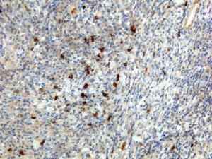 Human IgA Antibody Immunohistochemistry Human Lymphoid Tissue. Immunohistochemistry analysis of FFPE human lymphoid tissue using Human IgA Antibody / Anti-IgA Detection Antibody (clone RM128) demonstrates cytoplasmic staining in scattered plasma cells within lymphoid regions, while surrounding lymphocytes and stromal cells show minimal staining. The staining pattern supports detection of IgA / IGHA in antibody-secreting cells and is consistent with mucosal-associated immune populations. Heat-induced epitope retrieval was performed using pH6 citrate buffer or pH9 Tris-EDTA buffer prior to antibody incubation.