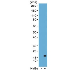 H3K14ac Antibody / HIST1H3A Chromatin Accessibility Activation Antibody (clone RM130) for WB. Western blot analysis of HIST1H3A / Histone H3 Lys14 acetylation in acid extracts of human HeLa cells untreated (-) and sodium butyrate-treated (+) using H3K14ac Antibody / HIST1H3A Chromatin Accessibility Activation Antibody. A band is detected at the predicted molecular weight of approximately 15 kDa corresponding to acetylated Histone H3, with increased signal in treated cells consistent with histone deacetylase inhibition and enhanced chromatin accessibility.