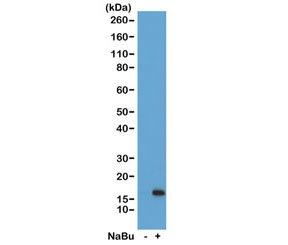 H3K36ac Antibody / HIST1H3A Transcription Elongation Marker Antibody (clone RM154) for WB. Western blot analysis of HIST1H3A / Histone H3 Lys36 acetylation in acid extracts of human HeLa cells untreated (-) and sodium butyrate-treated (+) using H3K36ac Antibody / HIST1H3A Transcription Elongation Marker Antibody. A band is detected at the predicted molecular weight of approximately 15 kDa corresponding to acetylated Histone H3, with increased signal in treated cells consistent with histone deacetylase inhibition and enhanced transcription-associated chromatin within gene bodies.
