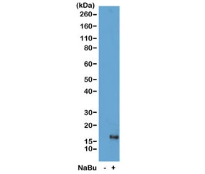 H3K79ac Antibody / HIST1H3A Gene Body Regulation Antibody (clone RM156) for WB. Western blot analysis of HIST1H3A / Histone H3 Lys79 acetylation in acid extracts of human HeLa cells untreated (-) and sodium butyrate-treated (+) using H3K79ac Antibody / HIST1H3A Gene Body Regulation Antibody. A band is detected at the predicted molecular weight of approximately 15 kDa corresponding to acetylated Histone H3, with increased signal in treated cells consistent with histone deacetylase inhibition and enhanced acetylation associated with gene body chromatin regulation and transcriptional progression.
