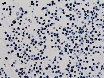 ICC testing of human HepG2 cells with recombinant H3K9ac antibody.