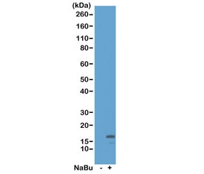 H3K18ac Antibody / HIST1H3A Transcription Activation Co-Activator Antibody (clone RM166) for WB. Western blot analysis of HIST1H3A / Histone H3 Lys18 acetylation in acid extracts of human HeLa cells untreated (-) and sodium butyrate-treated (+) using H3K18ac Antibody / HIST1H3A Transcription Activation Co-Activator Antibody. A band is detected at the predicted molecular weight of approximately 15 kDa corresponding to acetylated Histone H3, with increased signal in treated cells consistent with histone deacetylase inhibition and enhanced co-activator-associated transcriptional activation.