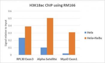 H3K18ac Antibody / HIST1H3A Transcription Activation Co-Activator Antibody (clone RM166) for ChIP. Chromatin immunoprecipitation analysis of HIST1H3A / Histone H3 Lys18 acetylation in human HeLa cells untreated and sodium butyrate-treated using H3K18ac Antibody / HIST1H3A Transcription Activation Co-Activator Antibody (5 ug). Quantitative PCR shows increased enrichment at the actively transcribed RPL30 Exon3 locus and elevated signal at MyoD Exon1 following treatment, with lower enrichment at alpha-satellite regions, consistent with H3K18ac marking co-activator-associated transcriptional activation and enhanced regulatory chromatin under histone deacetylase inhibition.
