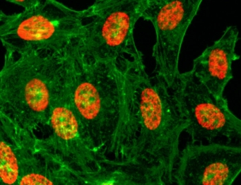 ICC/IF test of HeLa cells treated with sodium butyrate using H3K18ac antibody (red). Actin filaments have been labeled with fluorescein phalloidin (green).