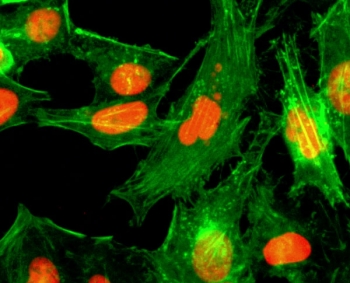 H4R3me1 Antibody for IF. Immunofluorescence analysis of histone H4 arginine 3 monomethylation in sodium butyrate-treated human HeLa cells using H4R3me1 Antibody (red). Nuclear staining is observed, consistent with localization of monomethylated histone H4 within chromatin. Actin filaments are labeled with fluorescein phalloidin (green), and nuclei are visualized with DAPI (blue), highlighting nuclear enrichment of this PRMT5 pathway-associated chromatin modification.