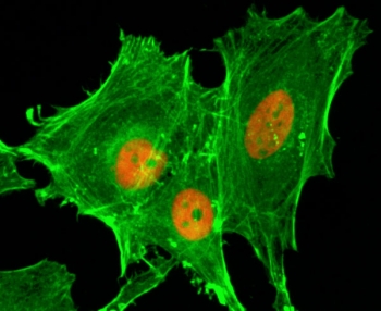 H4K20ac Antibody for IF. Immunofluorescence analysis of histone H4 lysine 20 acetylation in sodium butyrate-treated human HeLa cells using H4K20ac Antibody (red). Predominant nuclear staining is observed, consistent with localization of acetylated histone H4 (HIST1H4) within chromatin and reflecting chromatin states balancing compaction and accessibility. Actin filaments are labeled with fluorescein phalloidin (green), and nuclei are visualized with DAPI (blue), highlighting nuclear enrichment of this chromatin structure-associated acetylation mark.