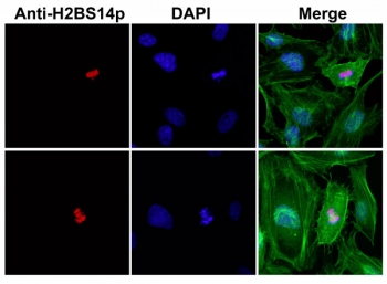 Phospho-Histone H2B Antibody pSer14 / HIST1H2B Apoptotic Chromatin Marker Antibody (clone RM238) for IF. Immunofluorescence analysis of HIST1H2B / Histone H2B Ser14 phosphorylation (H2B pS14) in human HeLa cells using Phospho-Histone H2B Antibody pSer14 / HIST1H2B Apoptotic Chromatin Marker Antibody. Discrete nuclear staining is observed (red), consistent with localized chromatin condensation in apoptotic cells, while nuclei are counterstained with DAPI (blue) and actin filaments are visualized in the cytoplasm (green), confirming nuclear-specific apoptotic chromatin signal.