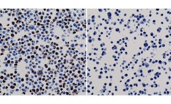 His Tag Antibody Biotin Conjugate Human 293T Cell ICC. Immunocytochemistry was performed using His Tag Antibody Biotin Conjugate clone RM146 on human HEK293T cells expressing a His-tagged nuclear protein (left) and negative control HepG2 cells lacking the tagged protein (right). Bound antibody was detected with streptavidin-HRP and DAB chromogen, followed by hematoxylin counterstaining. Strong nuclear staining is observed in the HEK293T cells expressing the His-tag fusion protein, while the negative control cells show no detectable staining. These results demonstrate that this Biotin His Tag Antibody provides specific detection of polyhistidine-tagged recombinant proteins in immunocytochemistry using a sensitive streptavidin-based detection system.
