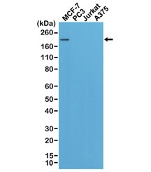 HER2 Antibody Multi-Cell Line WB. Western blot analysis of MCF-7, PC3, Jurkat, and A375 cell lysates using HER2 Antibody detects a band at approximately 185 kDa in the MCF-7 breast cancer cell line, consistent with the predicted molecular weight of ErbB2 / HER2, while other cell lines show minimal or no signal, reflecting differential expression of HER2 across cell types.