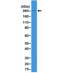 ACC1 Antibody for WB. Western blot analysis of Acetyl-CoA carboxylase 1 (ACACA) expression in human A431 cell lysate using ACC1 Antibody - Lipogenesis Enzyme (clone RM232). A band is detected at approximately 260 kDa, consistent with the predicted molecular weight of Acetyl-CoA carboxylase 1 (ACC1). This high molecular weight band represents the full-length cytosolic enzyme and may reflect regulatory phosphorylation states associated with metabolic signaling and lipogenic activity.