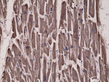 ACC Antibody Human Heart IHC. Immunohistochemistry analysis of Acetyl-CoA carboxylase 1 (ACACA) expression in FFPE human heart tissue using ACC1 Antibody - Lipogenesis Enzyme (clone RM232). Cytoplasmic HRP-DAB brown staining is observed in cardiac muscle cells, highlighting metabolic enzyme expression within cardiomyocytes, while nuclei are counterstained blue. The staining pattern is consistent with the cytosolic localization of ACC1 and reflects the metabolic activity of cardiac tissue.