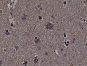 IHC testing of FFPE human cerebral cortex tissue with recombinant phospho-RSK1 antibody.