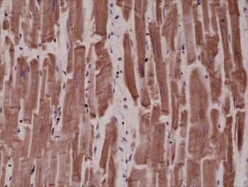 Recombinant Desmin Antibody Human Heart IHC. Immunohistochemistry testing of FFPE human heart tissue with recombinant Desmin antibody at 1:4000.