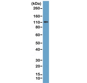 E-cadherin Antibody for WB. Western blot analysis of Cadherin 1 / CDH1 expression in human MCF7 cell lysate using clone RM244 antibody at 1:1000, showing a prominent band near the predicted molecular weight corresponding to mature E-cadherin. E-cadherin is synthesized as a precursor and undergoes glycosylation and processing, resulting in an apparent molecular weight typically observed between approximately 80-120 kDa, with the precursor form near 135 kDa. The detected band is consistent with glycosylated mature E-cadherin in epithelial cells.