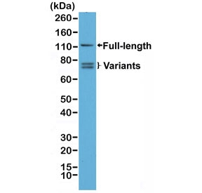 Androgen Receptor Antibody N-Terminal (clone RM254) detects androgen receptor protein in western blot analysis of human 22Rv1 cell lysate. A prominent band corresponding to the full-length androgen receptor is observed at approximately 110 kDa, while additional lower molecular weight bands represent AR splice variants that retain the N-terminal transactivation domain. Because this antibody targets the N-terminal region of AR, it recognizes both the intact receptor and truncated variant isoforms lacking the C-terminal ligand-binding domain.