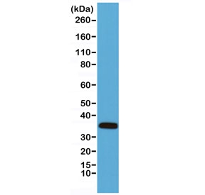 Calponin Antibody Mouse Heart WB. Western blot testing of mouse heart lysate with Calponin antibody. Predicted molecular weight ~33 kDa.