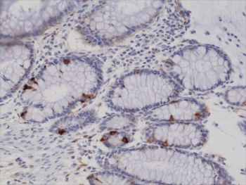 IHC testing of FFPE human colon tissue with recombinant Synaptophysin antibody. 