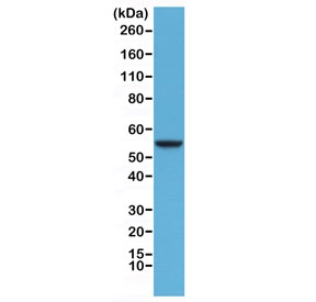 CK8 Antibody HeLa Western Blot. Western blot analysis of human HeLa cell lysate using recombinant CK8 Antibody (clone RM266) at a 1:1000 dilution demonstrates a distinct band at approximately 56 kDa, consistent with the expected molecular weight of Cytokeratin 8 (CK8/KRT8). Cytokeratin 8 is a type II intermediate filament protein widely expressed in simple epithelial cells and epithelial-derived malignancies, where it contributes to cytoskeletal organization, cellular integrity, and stress-response signaling. Detection of the expected molecular weight band supports expression of CK8 in HeLa cells and demonstrates the suitability of recombinant clone RM266 for western blot applications.