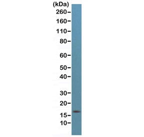 Western blot testing of human HeLa cell lysate with recombinant p16INK4a antibody at 1:500. Predicted molecular weight ~16 kDa.