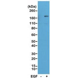 Phospho-EGFR Antibody A431 Stimulated WB. Western blot analysis of human A431 cell lysate untreated (-) or treated (+) with EGF using phospho-EGFR (Tyr1173) antibody, clone RM269. A band is detected at approximately 140-180 kDa in the EGF-treated sample, consistent with the predicted molecular weight of EGFR and its glycosylated forms. Signal is markedly increased following EGF stimulation, indicating phosphorylation of EGFR at Tyr1173 and confirming activation-dependent detection. Minimal signal is observed in the untreated sample, supporting specificity of the antibody for the phosphorylated form of EGFR.