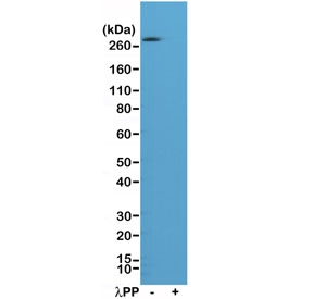 Phospho-ACC1 (Ser79) Antibody for WB. Western blot analysis of ACACA / Acetyl-CoA carboxylase 1 phosphorylation in human A431 cell lysate using Phospho-ACC1 (Ser79) Antibody - AMPK Signaling Marker (clone RM270) at 1:1000. Lysates were untreated (-) or treated (+) with lambda protein phosphatase (Î»PP). A band is detected at approximately 260 kDa in the untreated sample, consistent with phosphorylated ACC1, while signal is markedly reduced following phosphatase treatment, confirming phosphorylation-dependent detection at Ser79. This result supports specificity of the antibody for the phosphorylated form of ACC1 and reflects AMPK-mediated regulatory signaling.