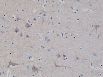 IHC testing of FFPE human brain tissue with recombinant Neurofilament antibody at 1:2500.
