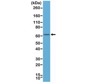 Estrogen Receptor alpha Antibody N-Terminal Region WB. Western blot analysis of Estrogen Receptor alpha antibody in human MCF-7 cell lysate. A distinct band is observed at approximately 66 kDa, consistent with the predicted molecular weight of Estrogen Receptor alpha / ESR1. The antibody used is a recombinant monoclonal directed against the N-terminal region of ER alpha and was applied at a 1:500 dilution. The observed band corresponds to the expected full-length ER alpha protein expressed in hormone-responsive breast carcinoma cells.