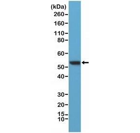 Vimentin Antibody C-Terminus WB. Western blot testing of human HeLa lysate with Vimentin Antibody C-Terminus / VIM C-Terminal Epitope Antibody at 1:400 dilution. Predicted molecular weight ~53 kDa.