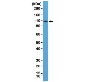 CD34 Antibody for WB. Western blot analysis of CD34 expression in mouse spleen lysate using clone RM300. Lane 1: mouse spleen tissue lysate. A band is detected at approximately 90-110 kDa, consistent with the predicted molecular weight of CD34 following extensive glycosylation. A weaker band near the lower range may correspond to less glycosylated or partially processed forms of the protein. The higher apparent molecular weight reflects known post-translational modification of CD34 as a heavily glycosylated cell surface protein, aligning with its expression in hematopoietic cell populations present in spleen tissue.